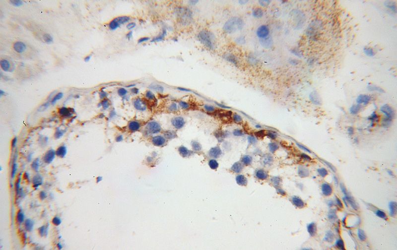 Immunohistochemical of paraffin-embedded human testis using Catalog No:111672(IFT81 antibody) at dilution of 1:50 (under 40x lens)