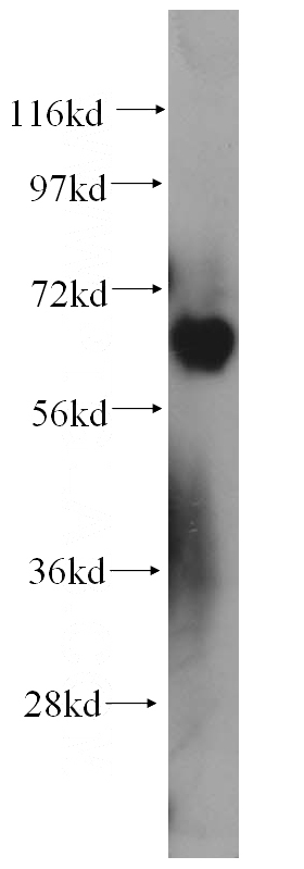 K-562 cells were subjected to SDS PAGE followed by western blot with Catalog No:113884(PIAS4 antibody) at dilution of 1:300
