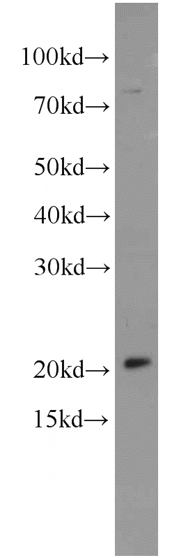 Jurkat cells were subjected to SDS PAGE followed by western blot with Catalog No:112832(MRPL48 antibody) at dilution of 1:800