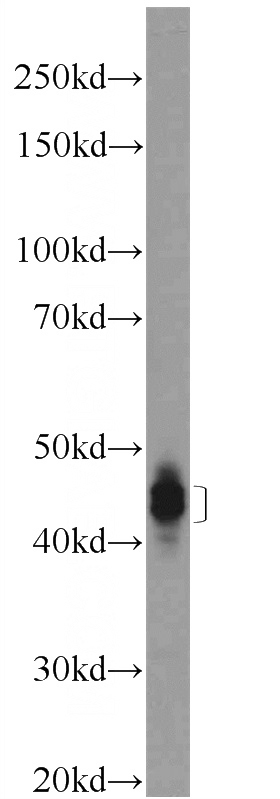 rat brain tissue were subjected to SDS PAGE followed by western blot with Catalog No:109887(EPB49 Antibody) at dilution of 1:300