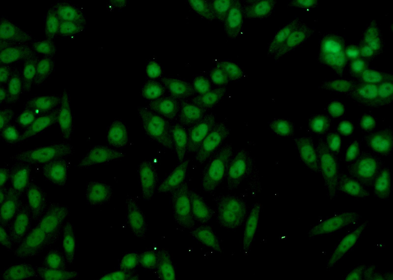 Immunofluorescent analysis of HeLa cells using Catalog No:114589(RBBP4 Antibody) at dilution of 1:50 and Alexa Fluor 488-congugated AffiniPure Goat Anti-Rabbit IgG(H+L)
