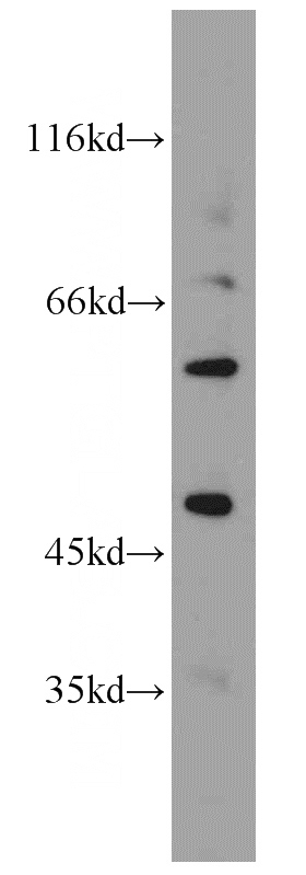 A549 cells were subjected to SDS PAGE followed by western blot with Catalog No:112058(KCNJ2 antibody) at dilution of 1:200