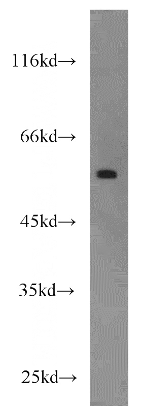 A375 cells were subjected to SDS PAGE followed by western blot with Catalog No:110693(FOXC2 antibody) at dilution of 1:1000