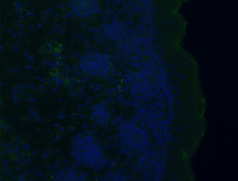 IF result of G0S2 antibody (Catalog No:110762,1:100, Green) with skin samples (mouse) at embryonic day 18 by Dr. Colin Jahoda.