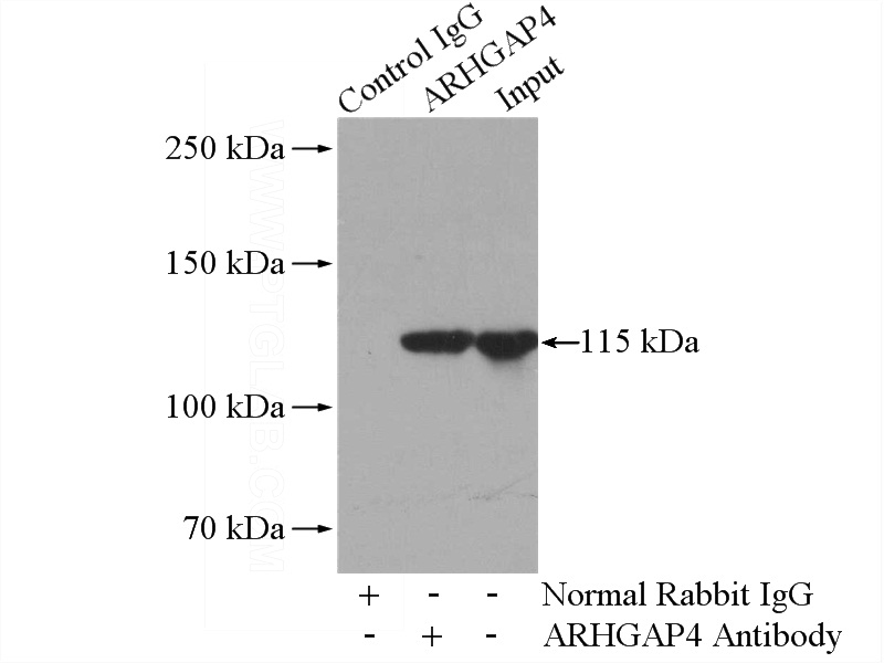 IP Result of anti-ARHGAP4 (IP:Catalog No:108177, 4ug; Detection:Catalog No:108177 1:500) with HL-60 cells lysate 1000ug.