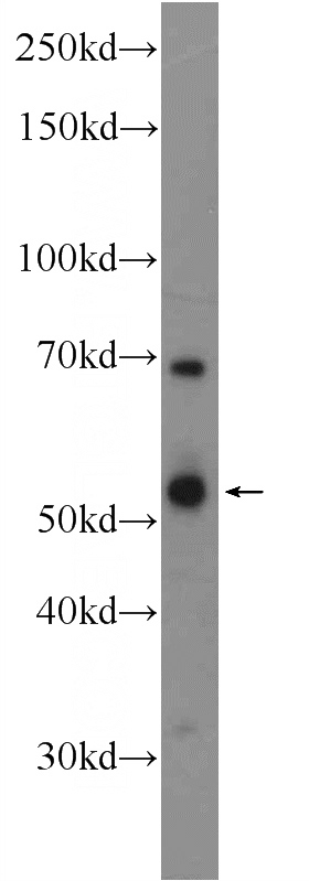 rat brain tissue were subjected to SDS PAGE followed by western blot with Catalog No:116264(TPH2 Antibody) at dilution of 1:300