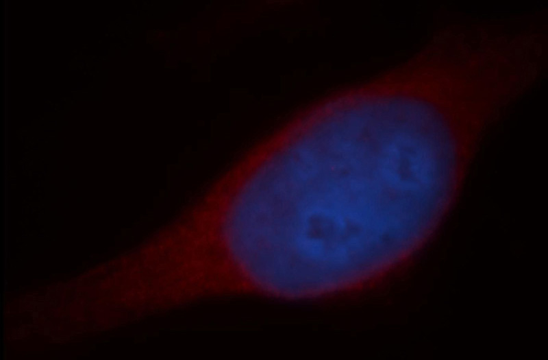 Immunofluorescent analysis of Hela cells, using CYP2S1 antibody Catalog No:109697 at 1:25 dilution and Rhodamine-labeled goat anti-rabbit IgG (red). Blue pseudocolor = DAPI (fluorescent DNA dye).