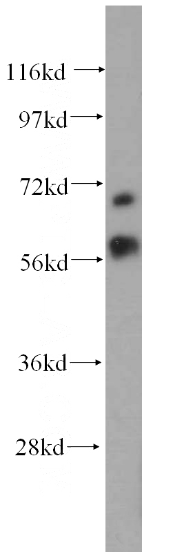 HepG2 cells were subjected to SDS PAGE followed by western blot with Catalog No:112764(MTA3 antibody) at dilution of 1:500