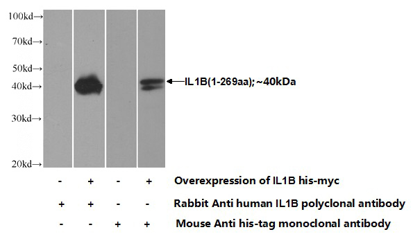 Transfected HEK-293 cells were subjected to SDS PAGE followed by western blot with Catalog No:111653(IL1B Antibody) at dilution of 1:700
