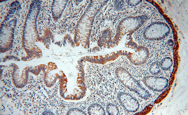 Immunohistochemical of paraffin-embedded human colon using Catalog No:116060(TINAG-Specific antibody) at dilution of 1:100 (under 10x lens)