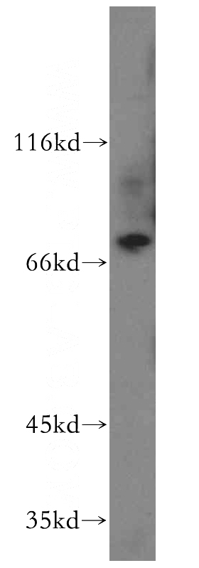 human placenta tissue were subjected to SDS PAGE followed by western blot with Catalog No:116161(TNS4 antibody) at dilution of 1:800