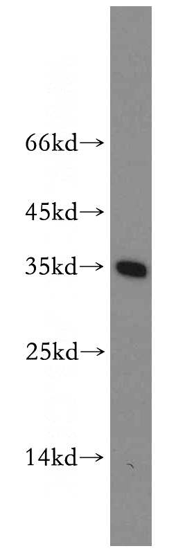 mouse liver tissue were subjected to SDS PAGE followed by western blot with Catalog No:107821(ABT1 antibody) at dilution of 1:300