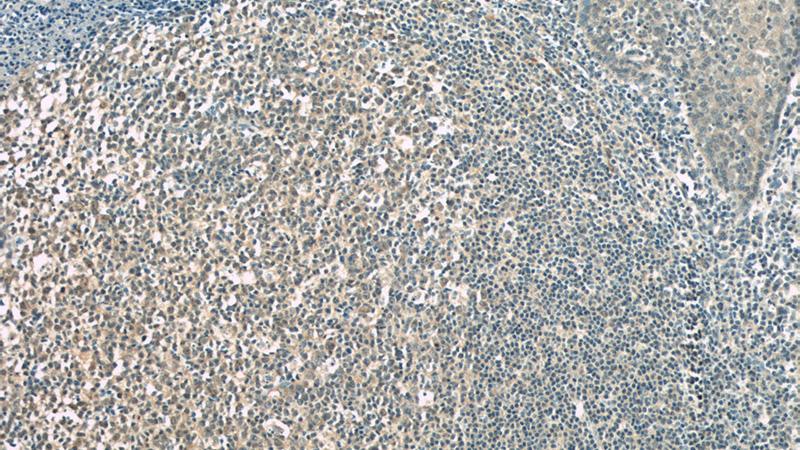 Immunohistochemical of paraffin-embedded human tonsillitis using Catalog No:109027(CD320 antibody) at dilution of 1:50 (under 10x lens)
