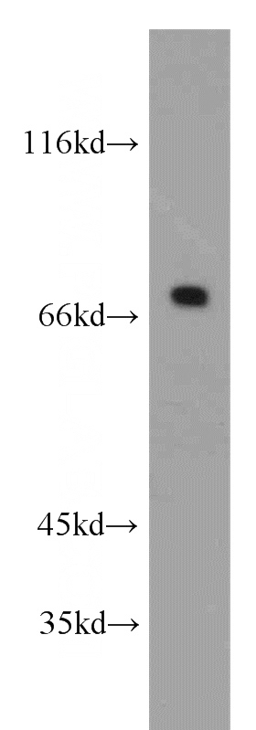 HEK-293 cells were subjected to SDS PAGE followed by western blot with Catalog No:115303(SLC13A4 antibody) at dilution of 1:500