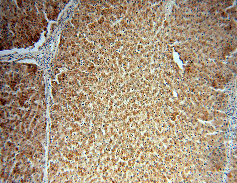 Immunohistochemical of paraffin-embedded human liver using Catalog No:108377(BBS9 antibody) at dilution of 1:50 (under 10x lens)