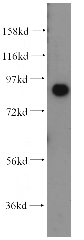 human heart tissue were subjected to SDS PAGE followed by western blot with Catalog No:116713(Aoc3 antibody) at dilution of 1:400