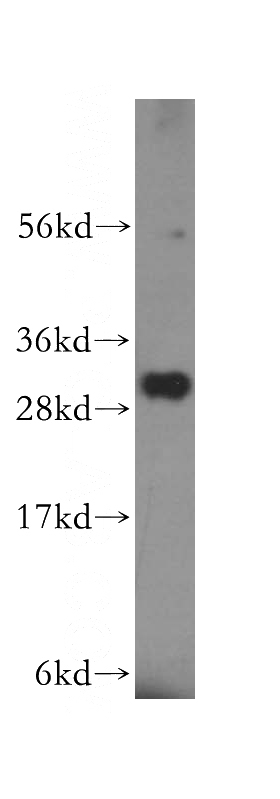 human kidney tissue were subjected to SDS PAGE followed by western blot with Catalog No:113193(NIT2 antibody) at dilution of 1:500