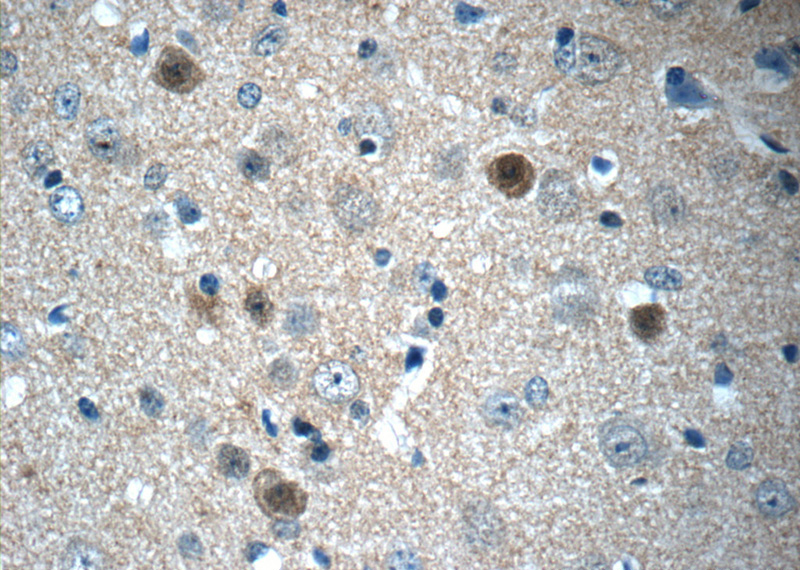Immunohistochemistry of paraffin-embedded mouse brain tissue slide using Catalog No:110630(FGF12 Antibody) at dilution of 1:50 (under 40x lens)