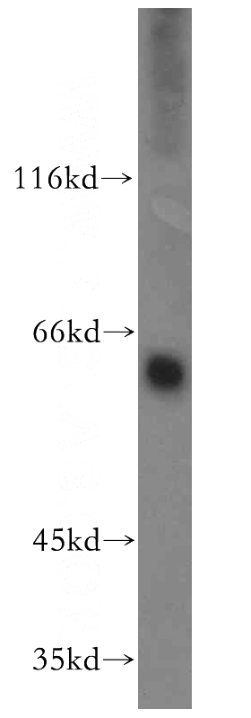 human placenta tissue were subjected to SDS PAGE followed by western blot with Catalog No:112469(MAOA antibody) at dilution of 1:300