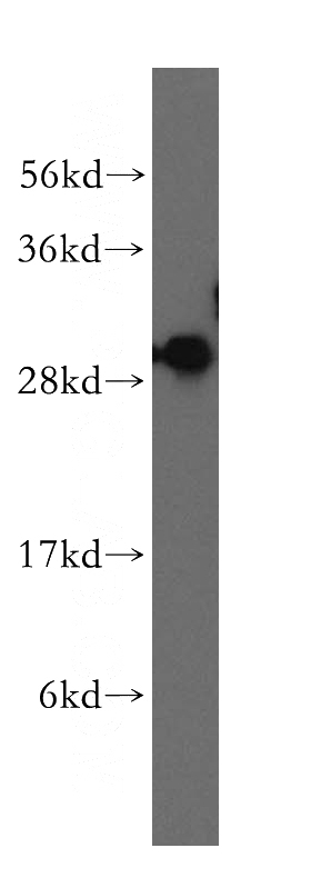human brain tissue were subjected to SDS PAGE followed by western blot with Catalog No:115159(SFXN1 antibody) at dilution of 1:400