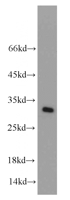 HeLa cells were subjected to SDS PAGE followed by western blot with Catalog No:112846(MRPS18B antibody) at dilution of 1:500