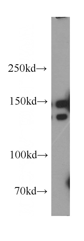 human brain tissue were subjected to SDS PAGE followed by western blot with Catalog No:113536(DCTN1 antibody) at dilution of 1:500