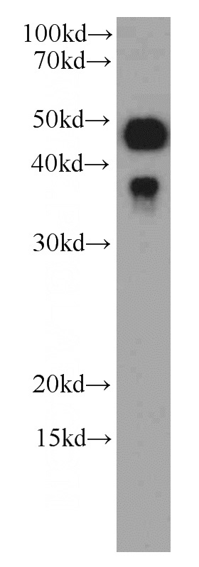 HeLa cells were subjected to SDS PAGE followed by western blot with Catalog No:107034(Caspase 9 Antibody) at dilution of 1:1000