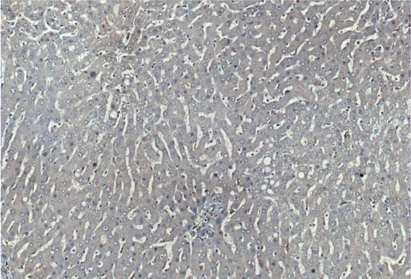 Immunohistochemistry of paraffin-embedded human liver tissue slide using (CD68 Antibody) at dilution of 1:200 (under 10x lens)