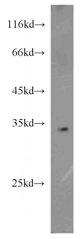 HepG2 cells were subjected to SDS PAGE followed by western blot with Catalog No:114902(RPL8 antibody) at dilution of 1:800