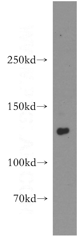 mouse thymus tissue were subjected to SDS PAGE followed by western blot with Catalog No:110079(DNA2 antibody) at dilution of 1:500
