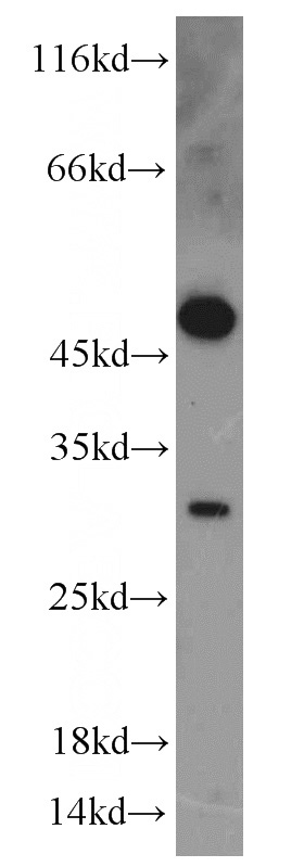 HeLa cells were subjected to SDS PAGE followed by western blot with Catalog No:116440(TSPAN1 antibody) at dilution of 1:300