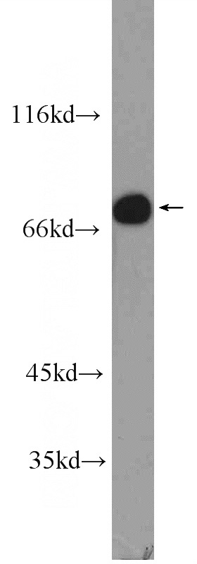 L02 cells were subjected to SDS PAGE followed by western blot with Catalog No:115317(SLC22A23 Antibody) at dilution of 1:1500