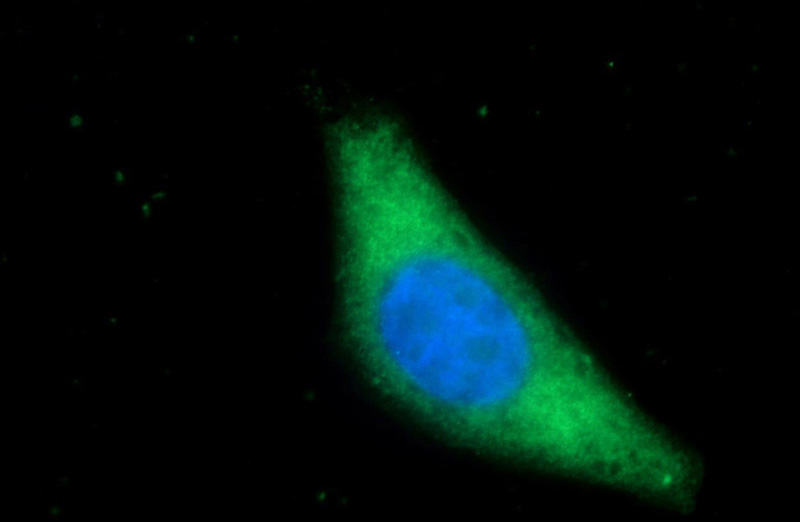 Immunofluorescent analysis of HepG2 cells using Catalog No:116025(TGFBRAP1 Antibody) at dilution of 1:25 and Alexa Fluor 488-congugated AffiniPure Goat Anti-Rabbit IgG(H+L)