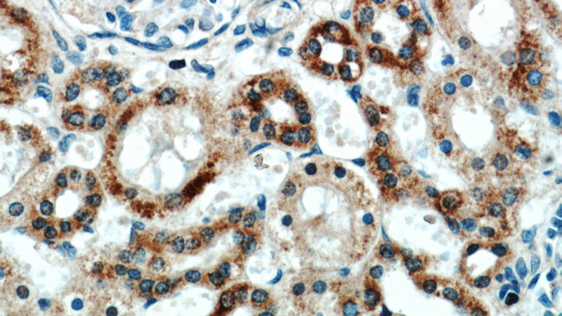 Immunohistochemical of paraffin-embedded human kidney using Catalog No:109214(CHCHD4 antibody) at dilution of 1:100 (under 40x lens)