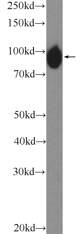 HepG2 cells were subjected to SDS PAGE followed by western blot with Catalog No:111326(H6PD Antibody) at dilution of 1:1000