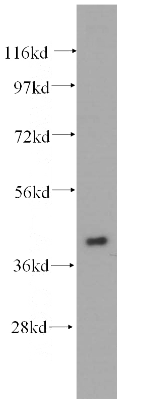 mouse brain tissue were subjected to SDS PAGE followed by western blot with Catalog No:110979(GIPC1 antibody) at dilution of 1:500