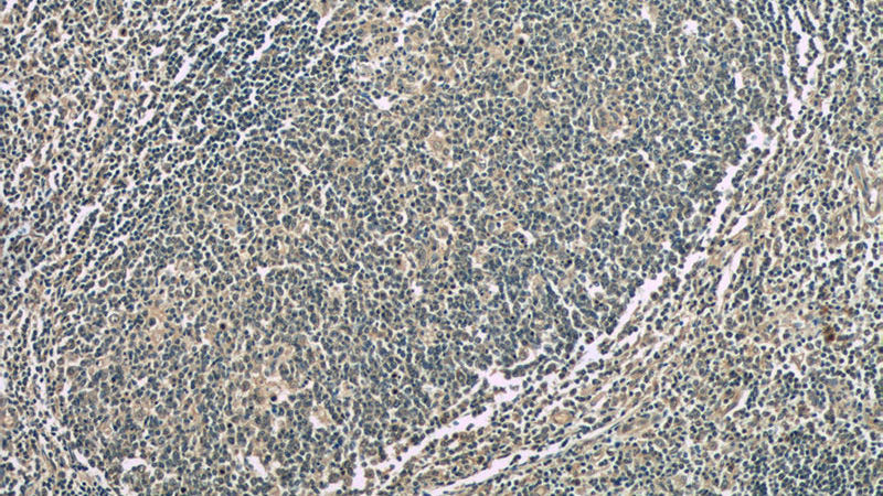Immunohistochemistry of paraffin-embedded human tonsillitis tissue slide using Catalog No:107404(IL9 Antibody) at dilution of 1:50 (under 10x lens)