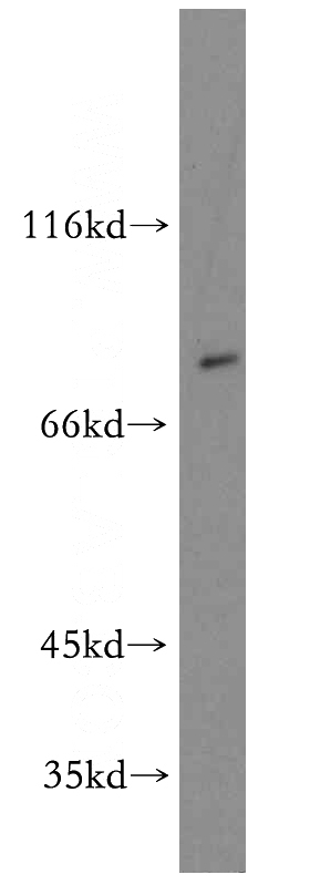 mouse testis tissue were subjected to SDS PAGE followed by western blot with Catalog No:108369(BBS2 antibody) at dilution of 1:500