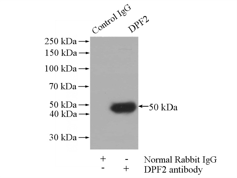 IP Result of anti-DPF2 (IP:Catalog No:110064, 4ug; Detection:Catalog No:110064 1:500) with Jurkat cells lysate 1200ug.