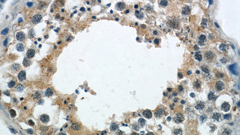 Immunohistochemistry of paraffin-embedded human testis tissue slide using Catalog No:109939(DICER1 Antibody) at dilution of 1:50 (under 40x lens)