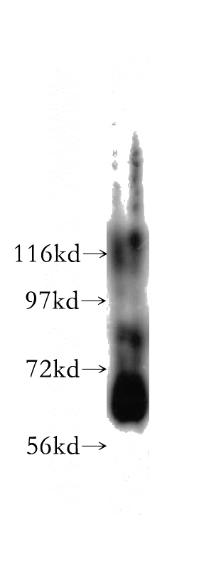 HEK-293 cells were subjected to SDS PAGE followed by western blot with Catalog No:107804(ABCE1 antibody) at dilution of 1:1500