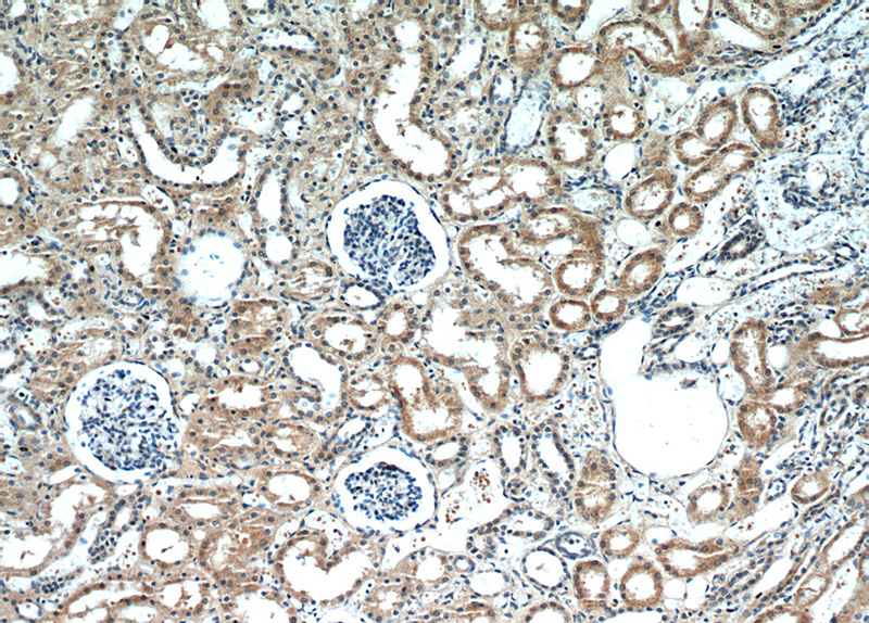 Immunohistochemical of paraffin-embedded human kidney using Catalog No:108969(CCDC25 antibody) at dilution of 1:50 (under 10x lens)