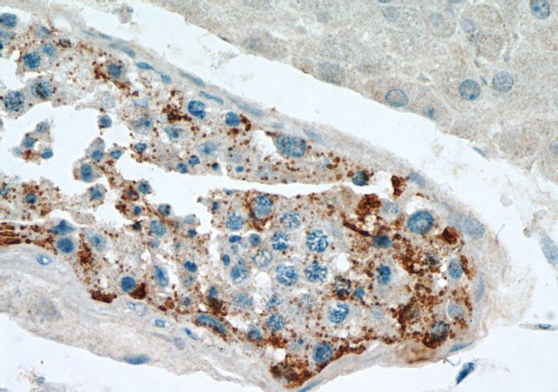 Immunohistochemical of paraffin-embedded human testis using Catalog No:115640(SPPL2A antibody) at dilution of 1:50 (under 40x lens)