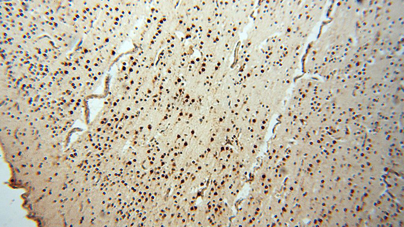 Immunohistochemical of paraffin-embedded human brain using Catalog No:112147(LARP4 antibody) at dilution of 1:50 (under 10x lens)