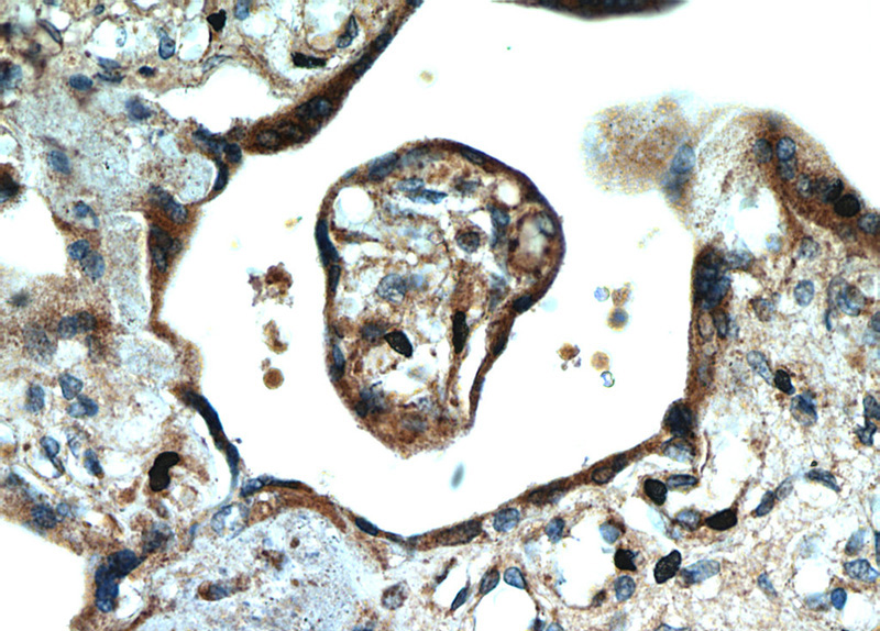 Immunohistochemical of paraffin-embedded human placenta using Catalog No:115419(SMAD4 antibody) at dilution of 1:50 (under 40x lens)