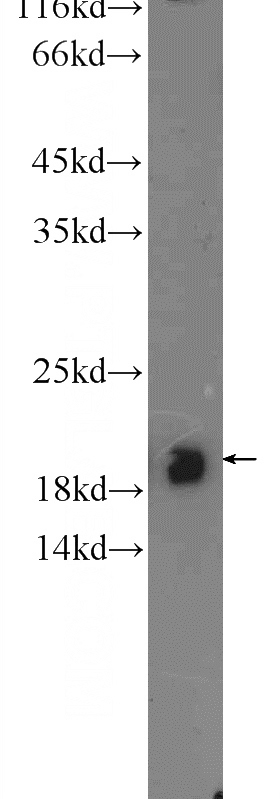 mouse cerebellum tissue were subjected to SDS PAGE followed by western blot with Catalog No:108937(CBLN4 Antibody) at dilution of 1:300