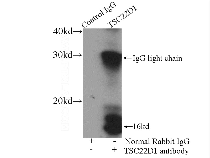 IP Result of anti-TSC22D1 (IP:Catalog No:116423, 4ug; Detection:Catalog No:116423 1:500) with rat brain tissue lysate 4000ug.