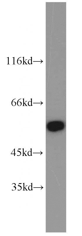 SKOV-3 cells were subjected to SDS PAGE followed by western blot with Catalog No:113633(PDLIM7,LMP1 antibody) at dilution of 1:2000