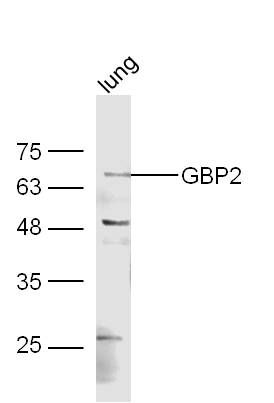 Fig1: Protein: mouse lung lysate;; Primary: rabbit Anti-GBP2 at 1:300;; Secondary: HRP conjugated Goat-Anti-rabbit IgG(bs-0295G-HRP) at 1: 5000;; Predicted band size: 67 kD; Observed band size: 67 kD