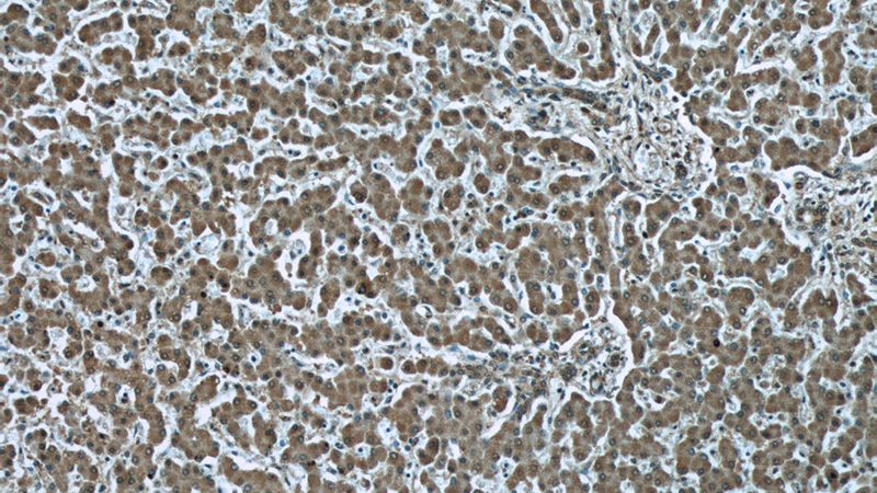 Immunohistochemistry of paraffin-embedded human liver tissue slide using Catalog No:107461(PDHA1 Antibody) at dilution of 1:50(under 10x lens)